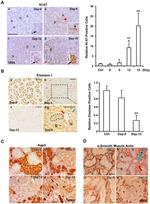 Ki-67 Antibody in Immunohistochemistry (Paraffin) (IHC (P))