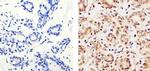Ki-67 Antibody in Immunohistochemistry (Paraffin) (IHC (P))