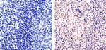 Ki-67 Antibody in Immunohistochemistry (Paraffin) (IHC (P))