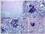 MMP1 Antibody in Immunohistochemistry (IHC)