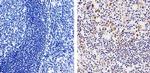 MMP9 Antibody in Immunohistochemistry (Paraffin) (IHC (P))