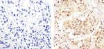 MEK1 Antibody in Immunohistochemistry (Paraffin) (IHC (P))