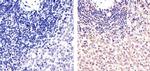 PARP1 Antibody in Immunohistochemistry (Paraffin) (IHC (P))