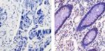 Cyclin D1 Antibody in Immunohistochemistry (Paraffin) (IHC (P))