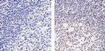 Cyclin D1 Antibody in Immunohistochemistry (Paraffin) (IHC (P))