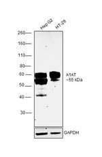 alpha-1 Antitrypsin Antibody in Western Blot (WB)