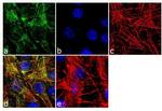 Alpha-Smooth Muscle Actin Antibody in Immunocytochemistry (ICC/IF)