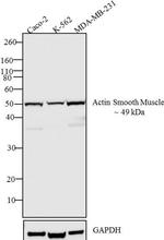 Alpha-Smooth Muscle Actin Antibody in Western Blot (WB)