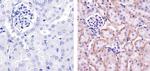 PDGFRA Antibody in Immunohistochemistry (Paraffin) (IHC (P))