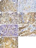 VEGF Antibody in Immunohistochemistry (Paraffin) (IHC (P))