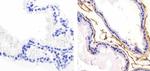 Pan-cadherin Antibody in Immunohistochemistry (Paraffin) (IHC (P))