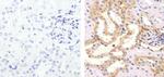 Pan-cadherin Antibody in Immunohistochemistry (Paraffin) (IHC (P))