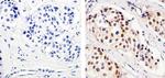 Cyclin D1 Antibody in Immunohistochemistry (Paraffin) (IHC (P))