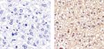 Cyclin D1 Antibody in Immunohistochemistry (Paraffin) (IHC (P))