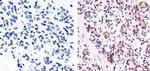 Ki-67 Antibody in Immunohistochemistry (Paraffin) (IHC (P))