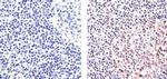 Ki-67 Antibody in Immunohistochemistry (Paraffin) (IHC (P))