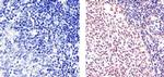 Ki-67 Antibody in Immunohistochemistry (Paraffin) (IHC (P))