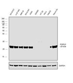 PGP9.5 Antibody in Western Blot (WB)