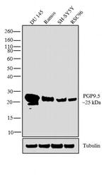 PGP9.5 Antibody in Western Blot (WB)