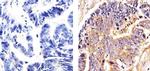 beta Tubulin Antibody in Immunohistochemistry (Paraffin) (IHC (P))