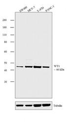 WT1 Antibody in Western Blot (WB)