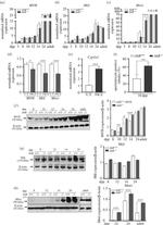 PIWIL1 Antibody in Western Blot (WB)
