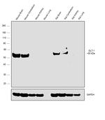 GLT-1 Polyclonal Antibody