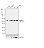 SMAD1 Polyclonal Antibody