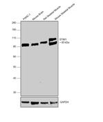 STIM1 Polyclonal Antibody