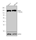 AS160 Polyclonal Antibody