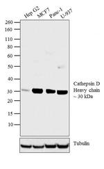 Cathepsin D Polyclonal Antibody
