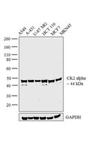 CK2 alpha-1 Polyclonal Antibody