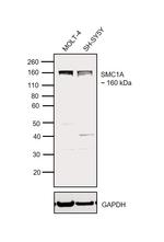 SMC1 Polyclonal Antibody