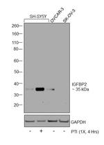 IGFBP2 Polyclonal Antibody