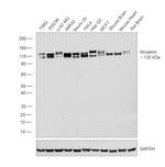 Nicastrin Polyclonal Antibody