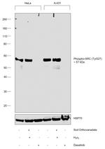 Phospho-SRC (Tyr530) Antibody in Western Blot (WB)
