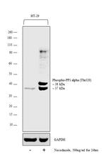 Phospho-PP1 alpha (Thr320) Polyclonal Antibody