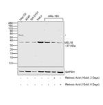 MEL18 Polyclonal Antibody