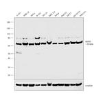 DDX5 Polyclonal Antibody