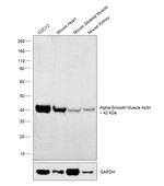Alpha-Smooth Muscle Actin Polyclonal Antibody