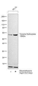 Tyrosine Hydroxylase Antibody