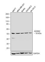 beta-2 Adrenergic Receptor Polyclonal Antibody