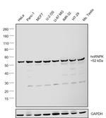 hnRNP K Antibody in Western Blot (WB)