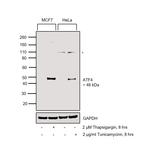 ATF4 Antibody in Western Blot (WB)