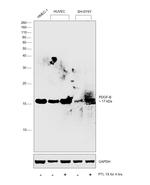 PDGF-B Polyclonal Antibody