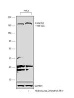 FANCD2 Antibody in Western Blot (WB)