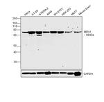Menin Antibody in Western Blot (WB)