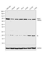IRAK1 Polyclonal Antibody