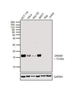 DRAM Antibody in Western Blot (WB)