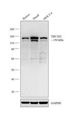 TBC1D1 Polyclonal Antibody
